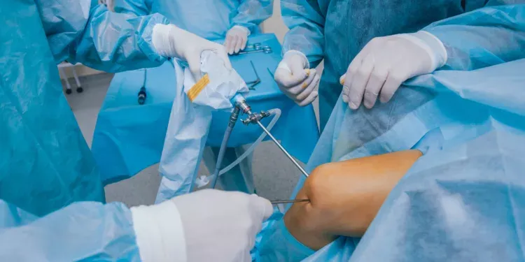 Knie-Arthroskopie Chirurgie. Orthopäden in Teamarbeit im Operationssaal mit modernen arthroskopischen Instrumenten. Knieoperation. Krankenhaushintergrund