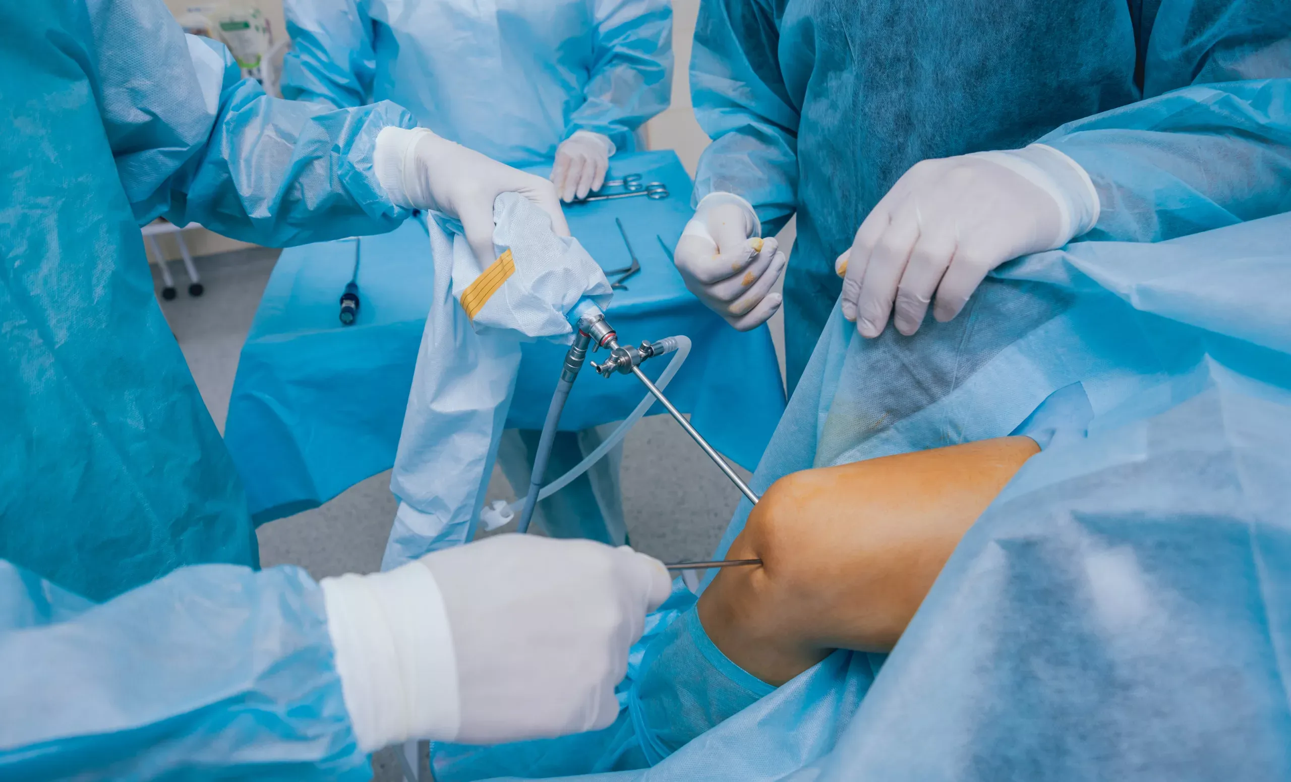 Knie-Arthroskopie Chirurgie. Orthopäden in Teamarbeit im Operationssaal mit modernen arthroskopischen Instrumenten. Knieoperation. Krankenhaushintergrund
