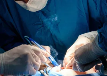 Der Chirurg hält während der minimalinvasiven Operation den elektrischen Koagulator. Nahaufnahme von Händen in sterilen Handschuhen, die mit Blut befleckt sind. Blaue Uniform und medizinische Masken. Chirurgischer Rauch von verbranntem Fleisch.